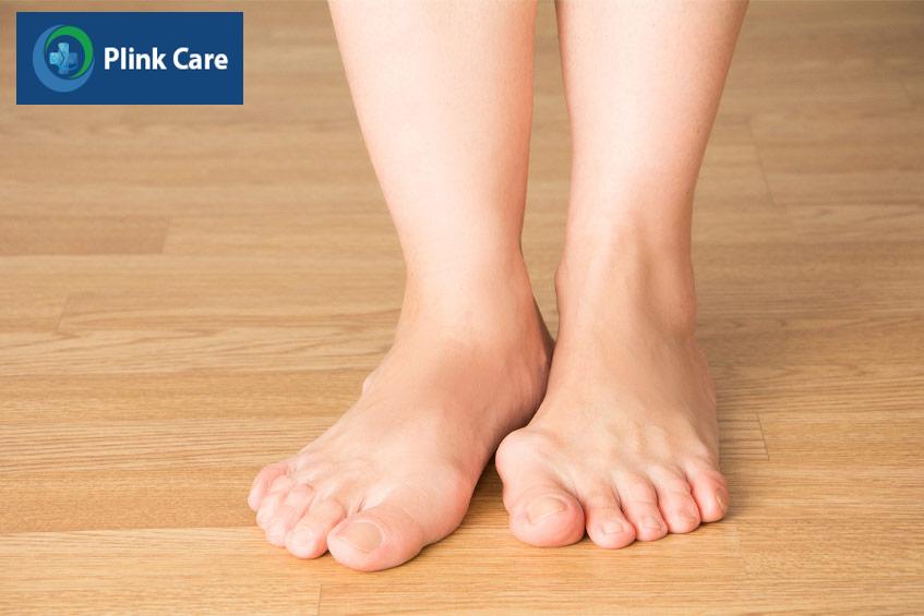 Dị tật bàn chân dễ mắc các bệnh cơ xương khớp
