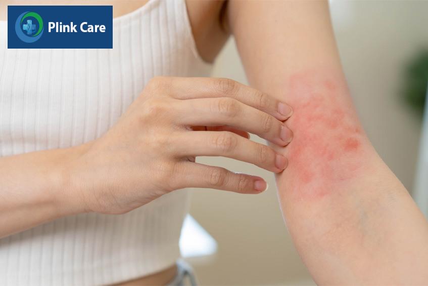 đỏ và kích ứng da
