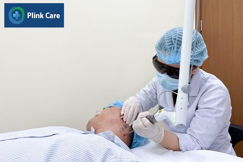 hiệu quả xoá xăm phụ thuộc nhiều yếu tố