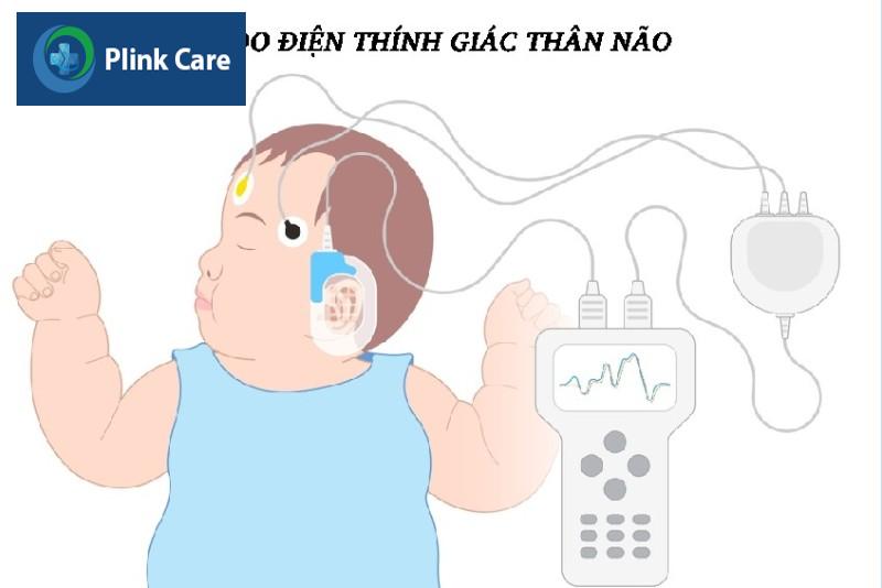 Các nghiệm pháp đo thính lực khách quan