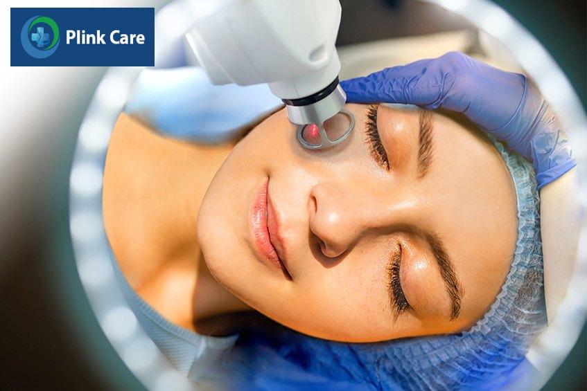 laser xóa nếp nhăn