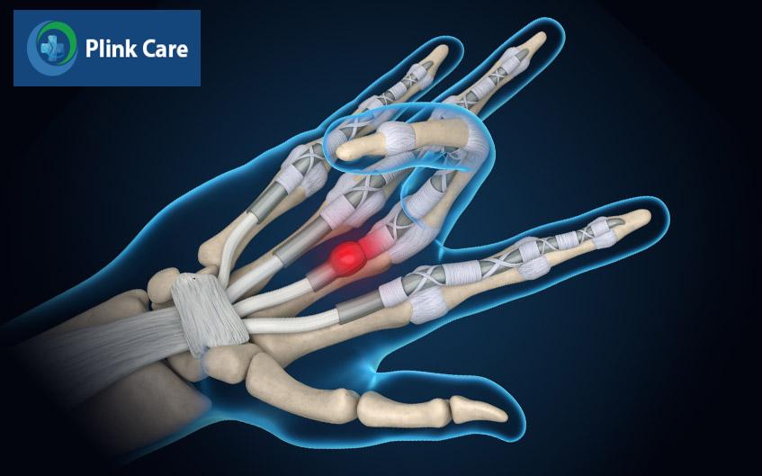 ngón tay bị cứng cố định ở 1 tư thế
