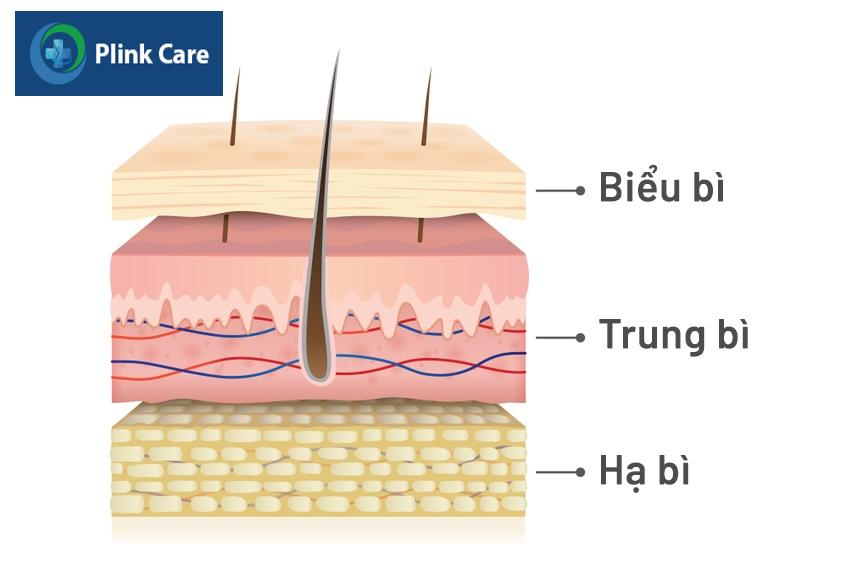 nguyên nhân gây nám chân đinh