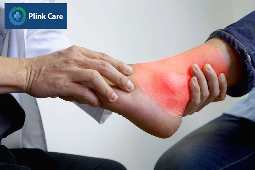nhận biết các dấu hiệu tràn dịch cổ chân