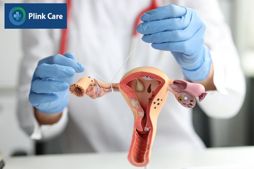 Phụ nữ cần điều trị triệt để dịch ứ vòi trứng trước khi làm IVF