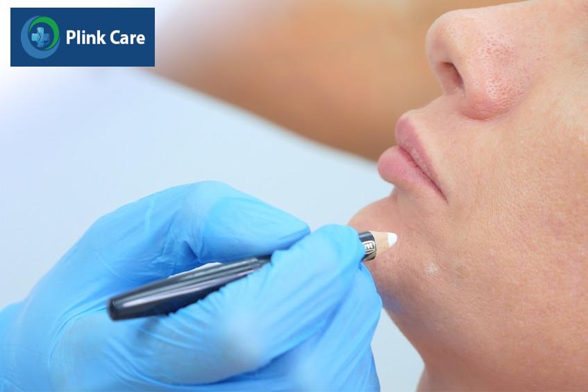 quy trình tiêm bap 5 điểm tại PlinkCare