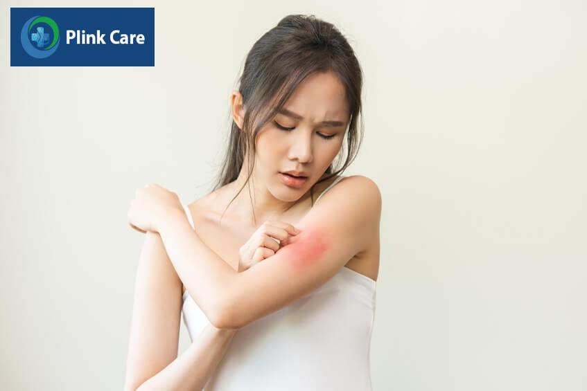 tác dụng phụ của thuốc ngủ gây phát ban ngứa
