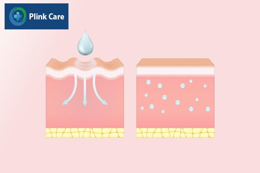 thiếu nước da khô có thể gây nhăn mắt