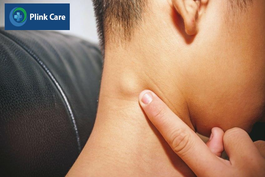 Triệu chứng nổi hạch ở cổ bên phải ở trẻ em