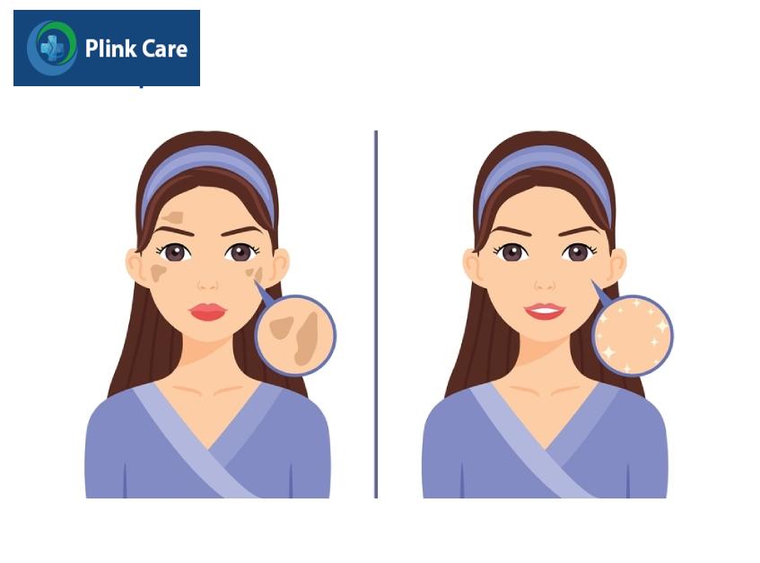 trước và sau điều trị