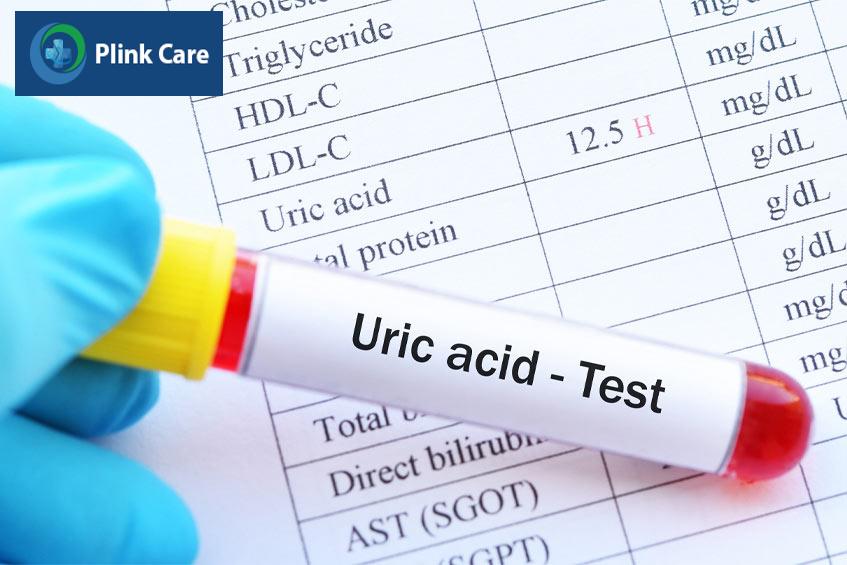 Uống thuốc hạ acid uric máu khi có triệu chứng gout