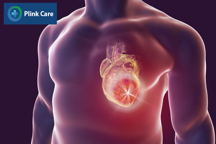 Viêm cơ tim nặng có thể dẫn đến rối loạn nhịp tim, suy tim, gây tử vong