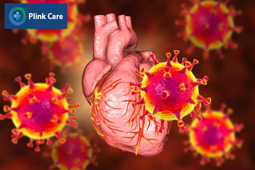 Nguyên nhân hình thành viêm cơ tim có liên quan đến nhiễm khuẩn, virus