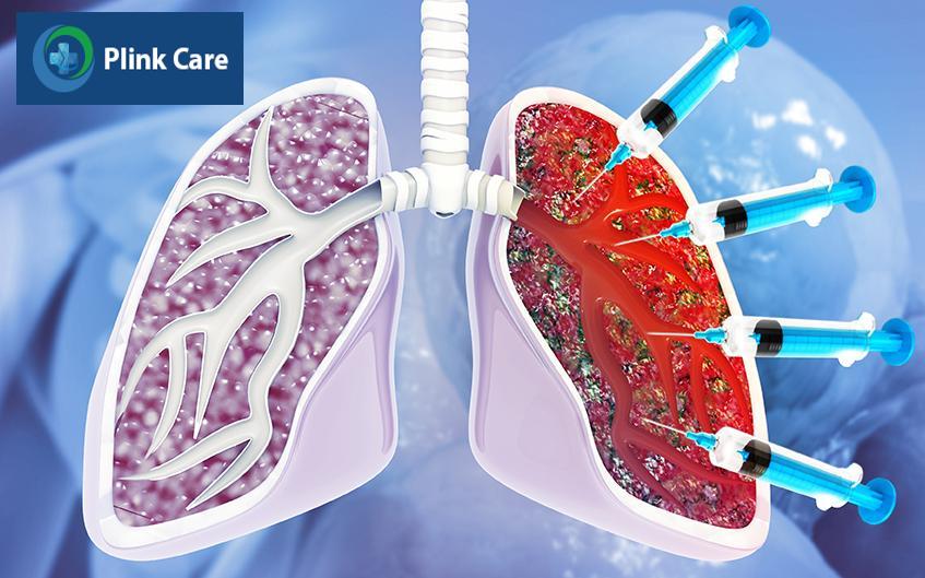 Viêm phổi kẽ có thể dùng thuốc điều trị
