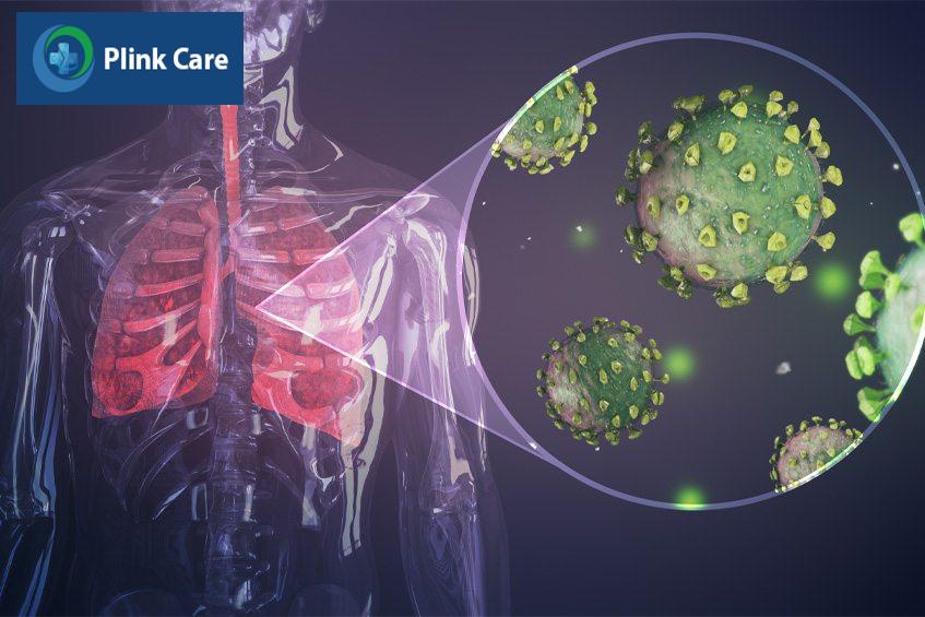 Virus gây viêm phổi cấp dễ dàng lây truyền trong cộng đồng