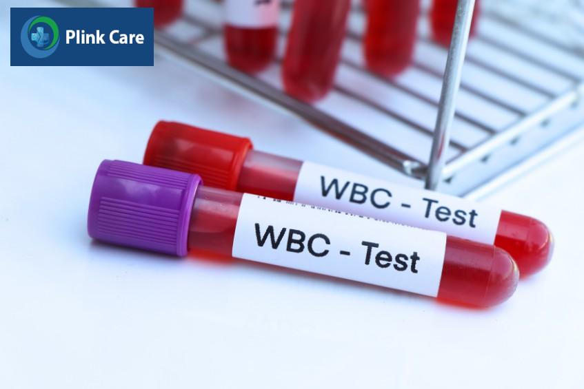 Xét nghiệm công thức máu WBC hỗ trợ bác sĩ chẩn đoán bệnh lý
