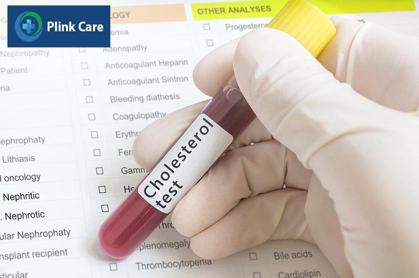 Xét nghiệm máu cho biết cụ thể các chỉ số cholesterol toàn phần