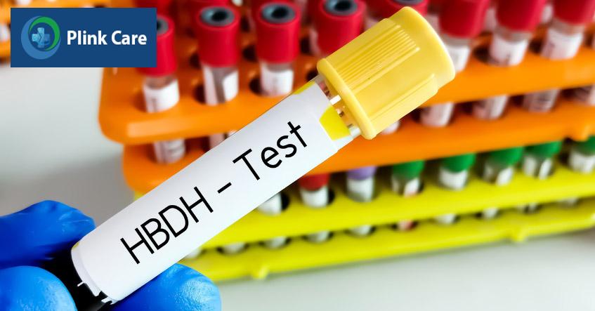 Xét nghiệm sinh hóa máu có thể phát hiện bất thường làm tăng nguy cơ nhồi máu cơ tim