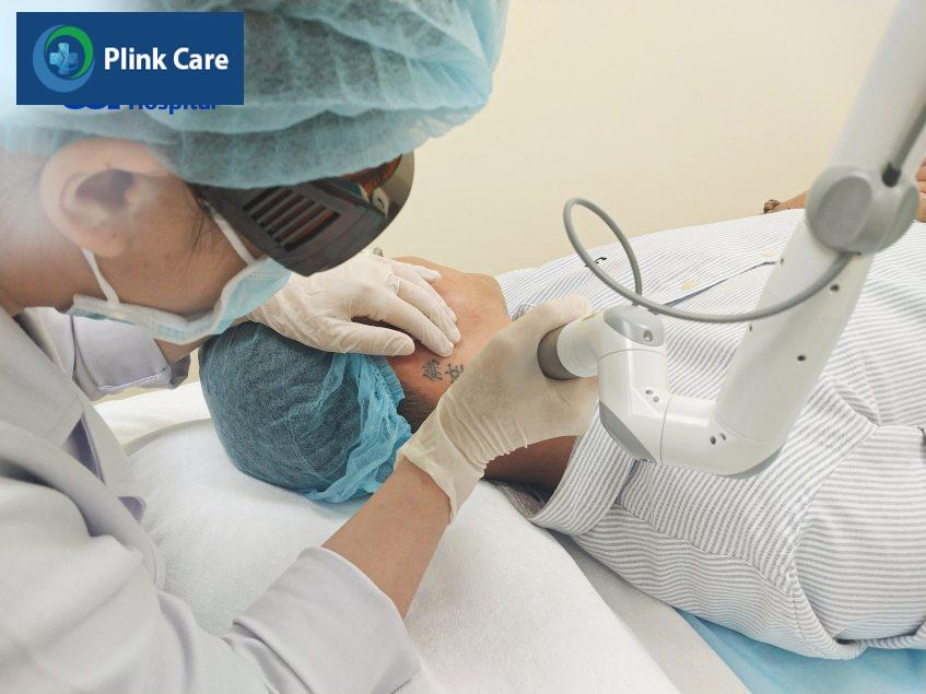 xóa xăm bằng laser tại PlinkCare