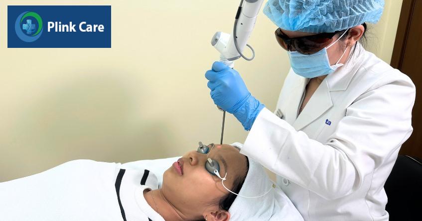 xóa xăm chân mày tại PlinkCare
