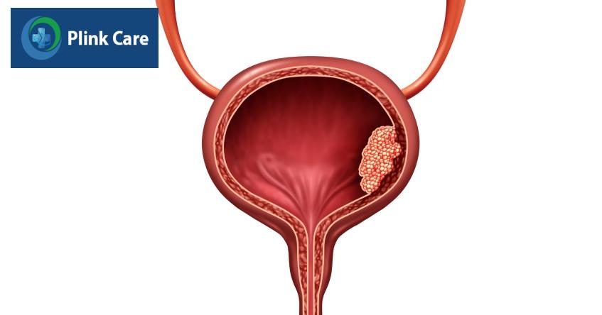 yếu tố ảnh hưởng đến kết quả điều trị