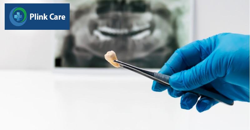 Tầm quan trọng của việc chăm sóc sau nhổ răng đúng cách