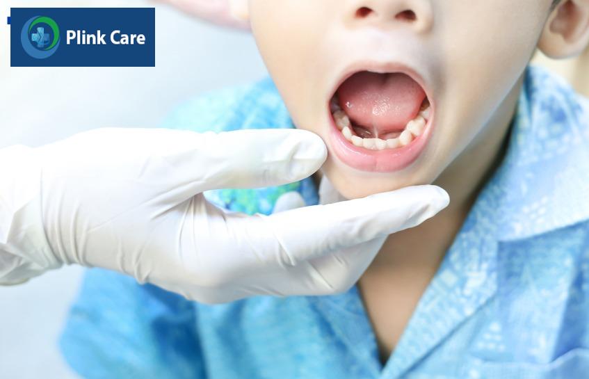 cắt thắng lưỡi cho bé có đau không