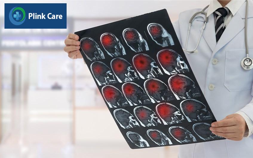 chăm sóc tiên lượng bệnh u não sống được bao lâu