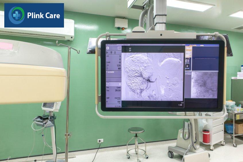chụp mạch số hóa xóa nền dsa