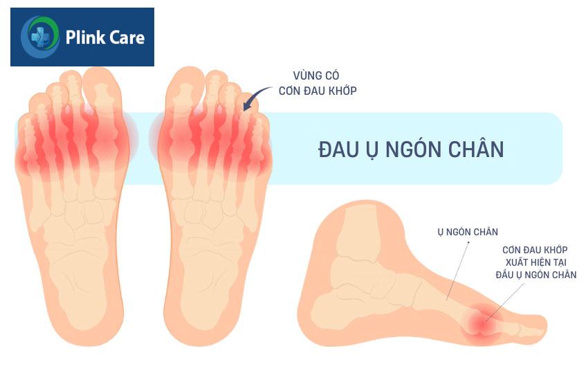 cơn đau gây ảnh hưởng đến sinh hoạt
