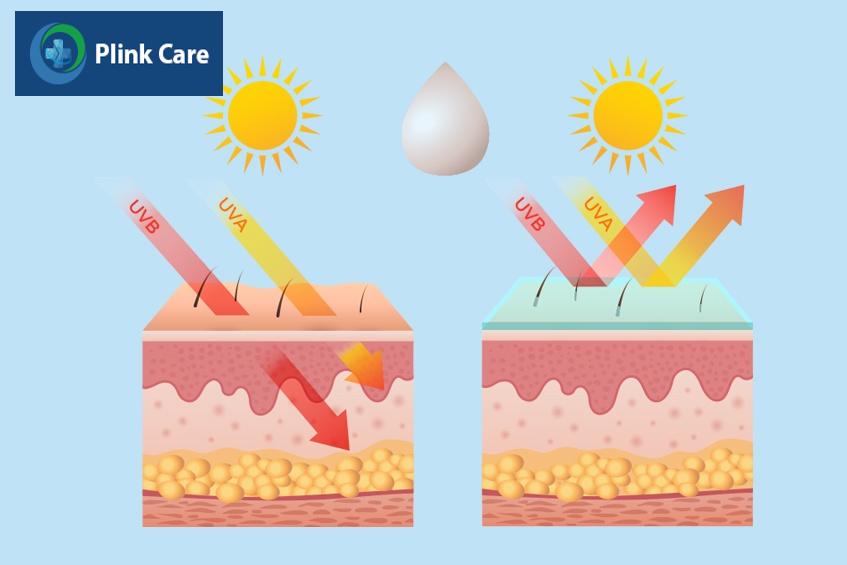 da tiếp xúc ánh năng nguyên nhân gây náp chân sâu