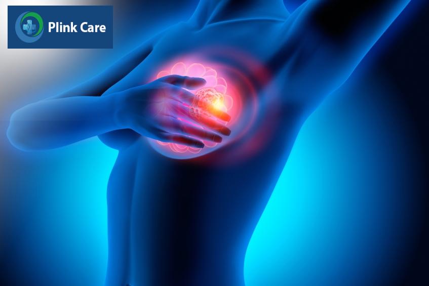 đau dai dẳng sau điều trị ung thư vú