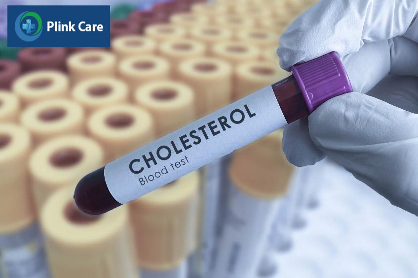 Mẫu máu được đưa đến Trung tâm Xét nghiệm để kiểm tra cholesterol