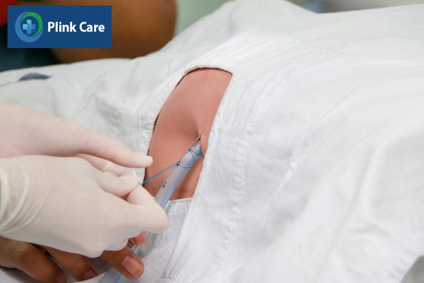 minh họa kỹ thuật mở màng phổi tối thiểu