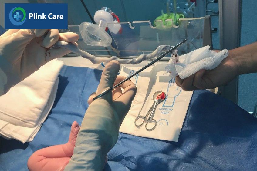 nguồn gốc tế bào gốc đa năng ở trẻ sơ sinh