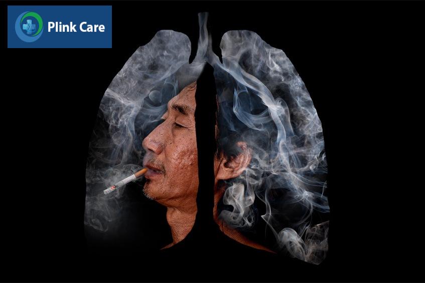 nguy cơ mắc bệnh bệnh phổi tắc nghẽn mạn tính giai đoạn 1