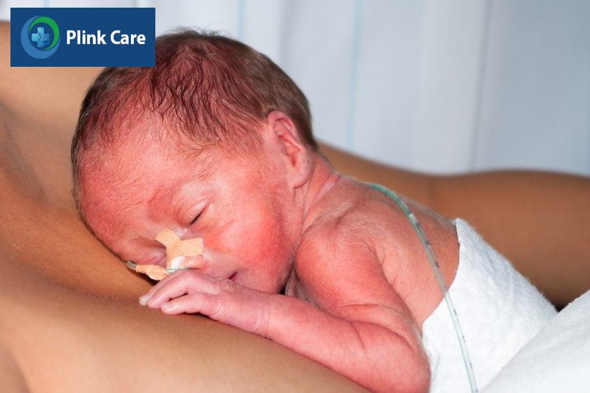 nguy cơ ở em bé sinh non 26 tuần tuổi cần chú ý