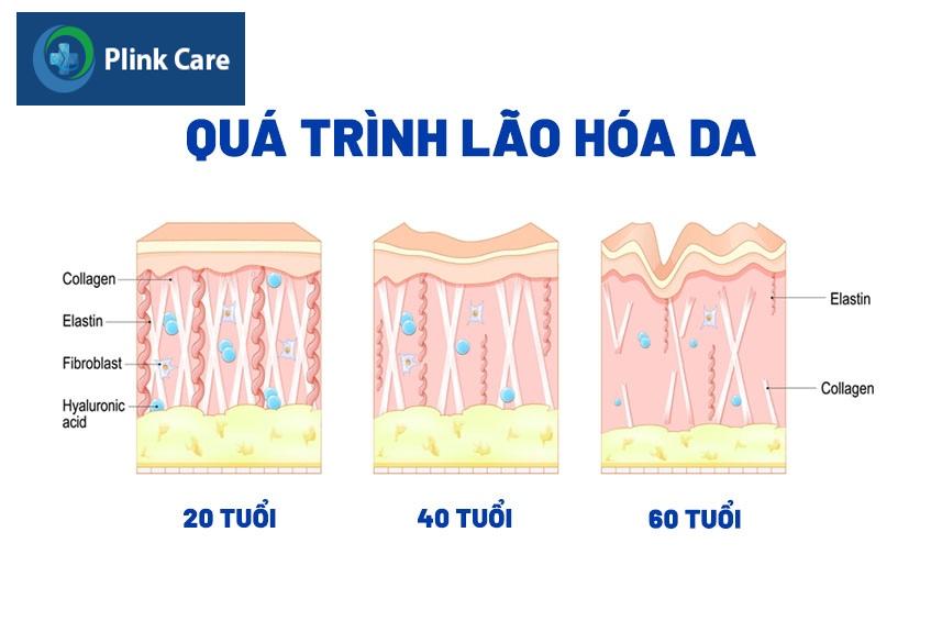 nguyên nhân gây lão hóa da