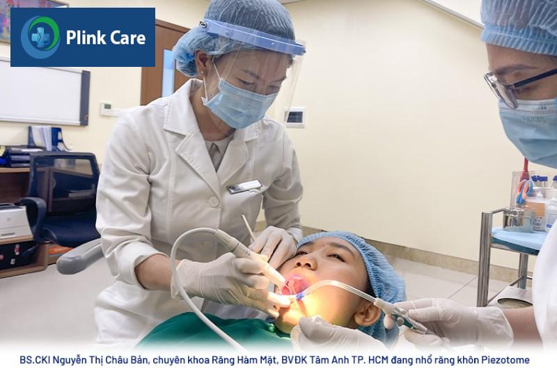 Nhổ răng khôn Piezotome là gì?