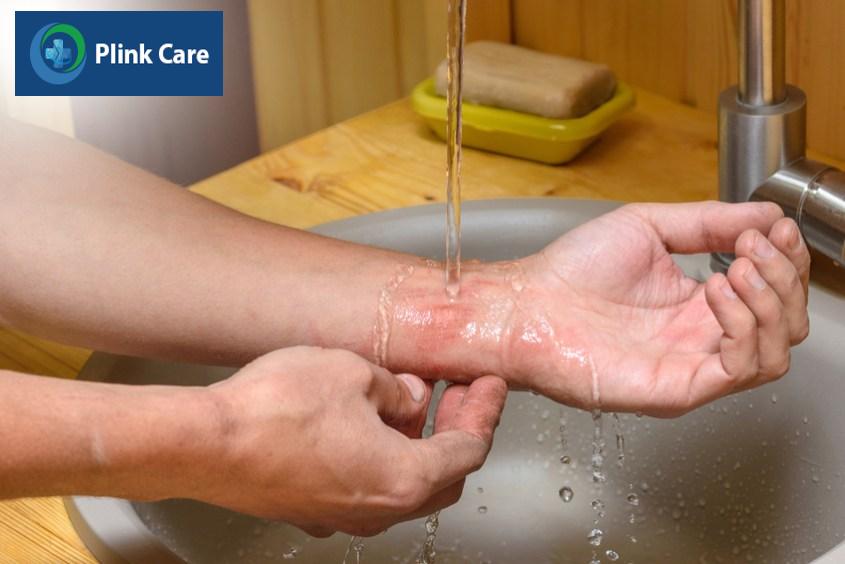 sát khuẩn vệ sinh vết thương