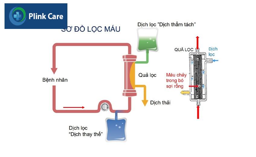 sơ đồ lọc máu liên tục