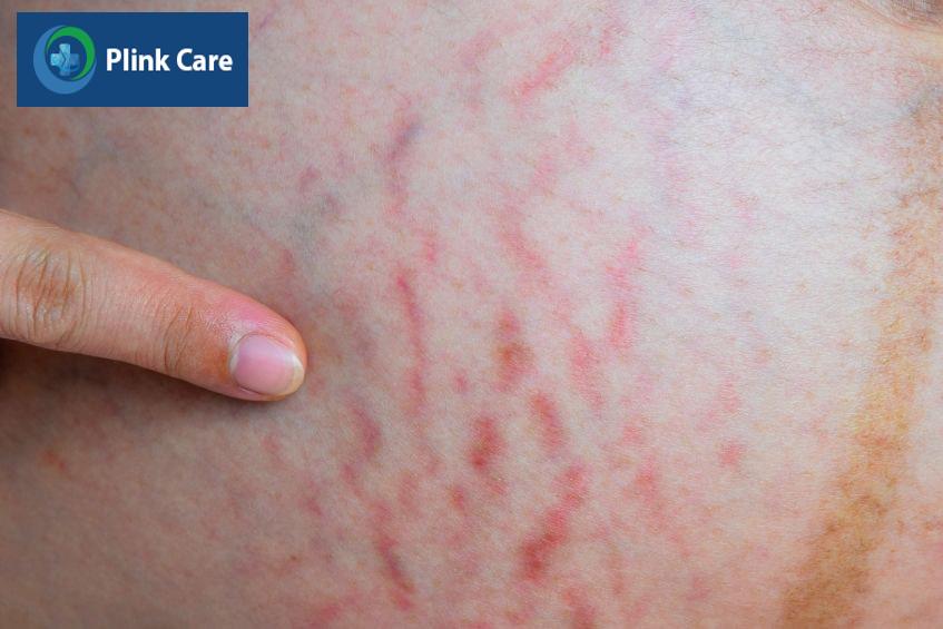 sự phát triển kích thước của bầu ngực