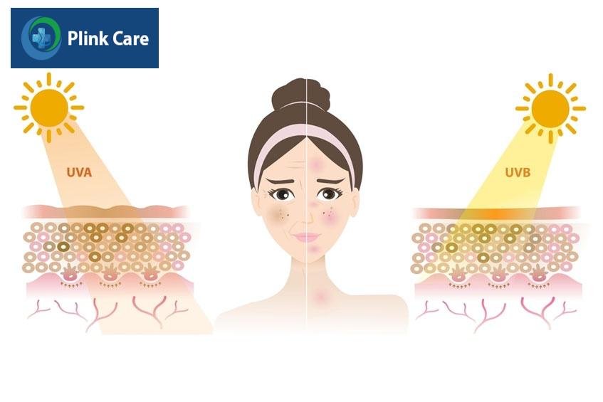 tác hại của tia uv với làn da