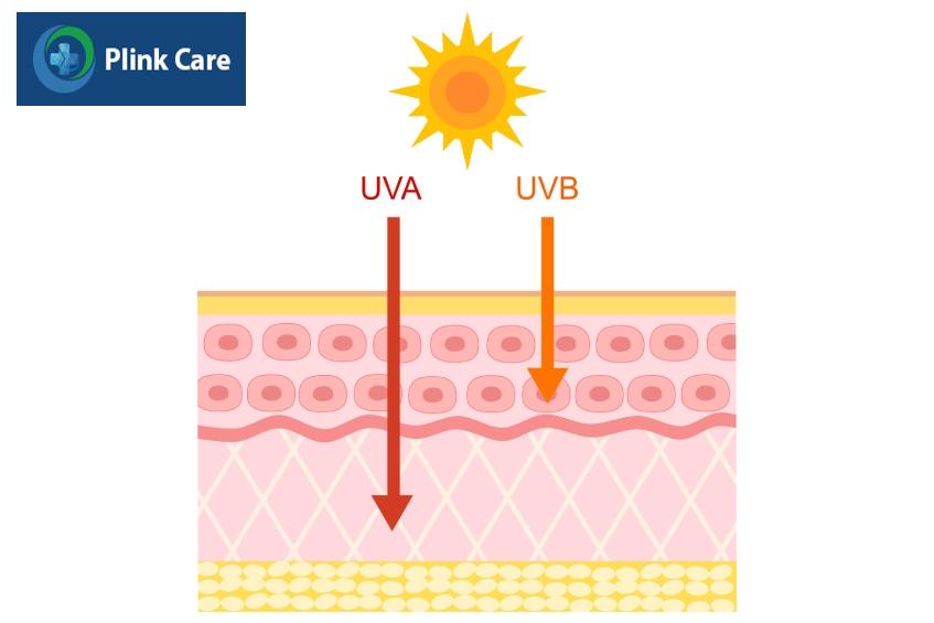 tiếp xúc ánh nắng gây ung thư