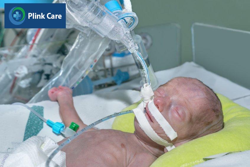 Trẻ sinh non tháng cần được hỗ trợ hô hấp