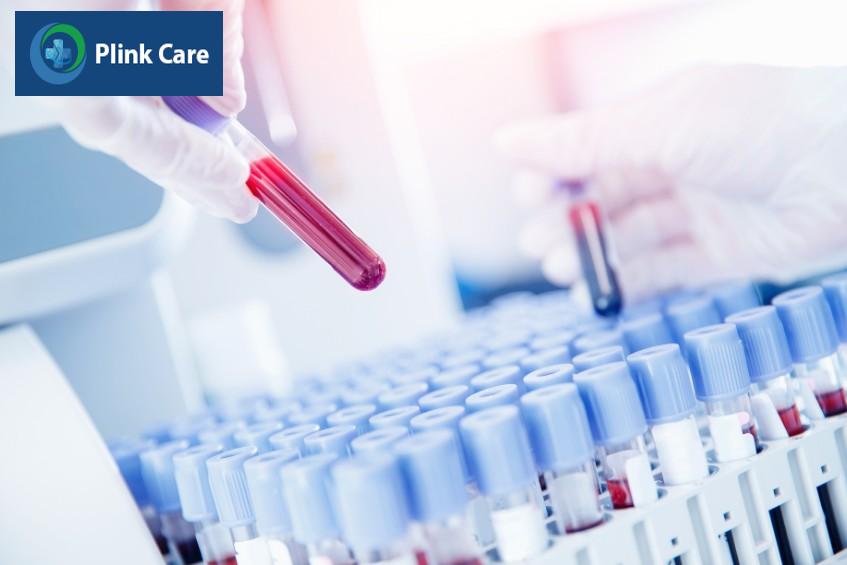 xét nghiệm máu bao nhiêu tiền còn phụ thuộc vào phương pháp và chất lượng máy móc
