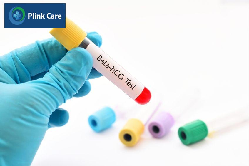 xét nghiệm máu giúp xác định nồng độ hcg