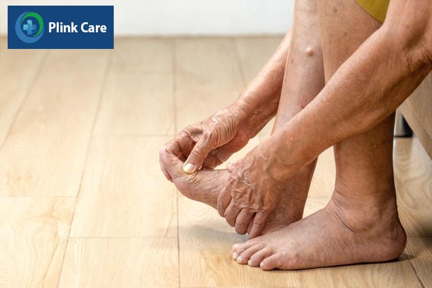 bàn chân tiểu đường khiến vùng da chân người bệnh khô, nứt