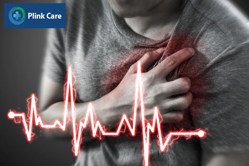Bệnh nhân có tỷ lệ cao mắc block nhĩ thất độ 2 sau khi bị nhồi máu cơ tim