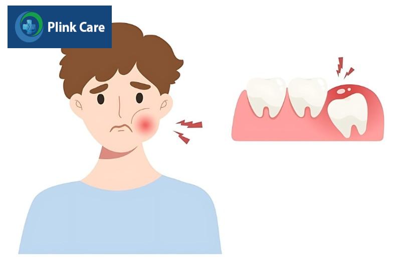 Điều trị biến chứng sau khi nhổ răng